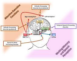 AUDITORY PROCESSING DISORDER